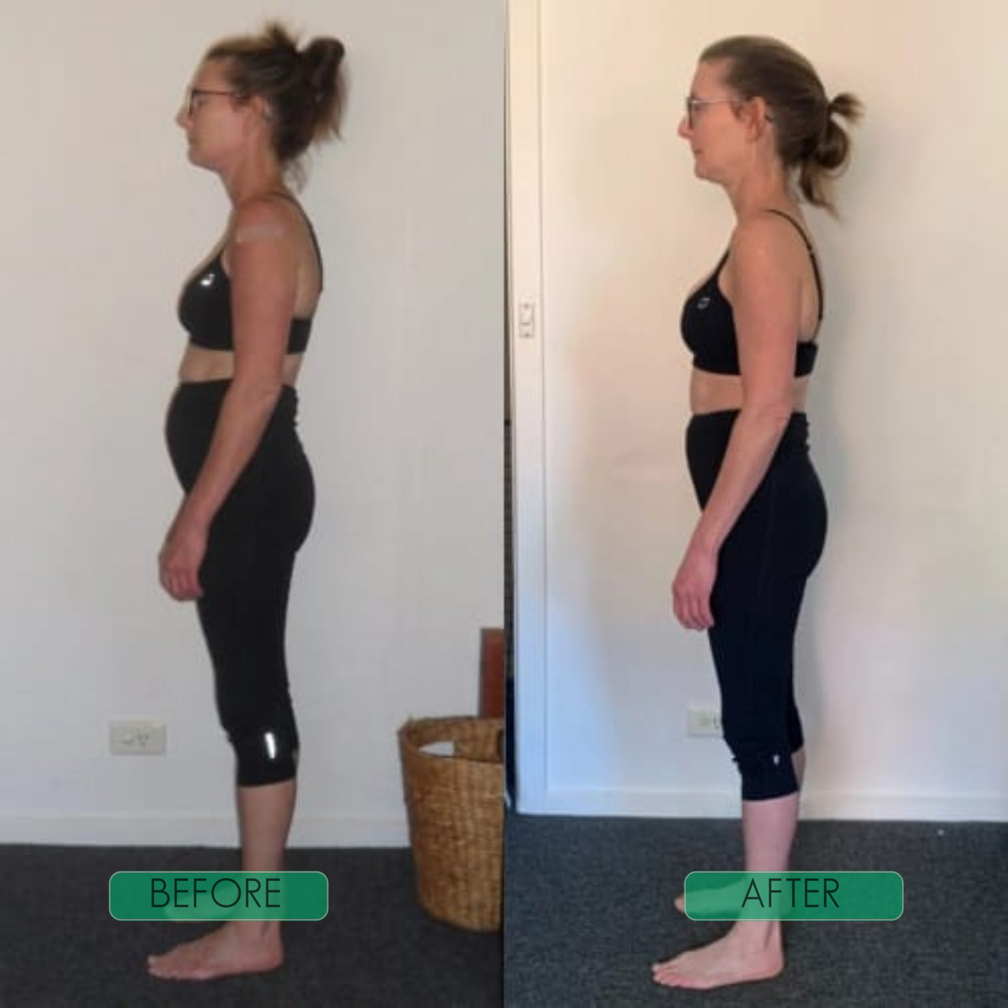 CoreAlign Instant Posture Corrector